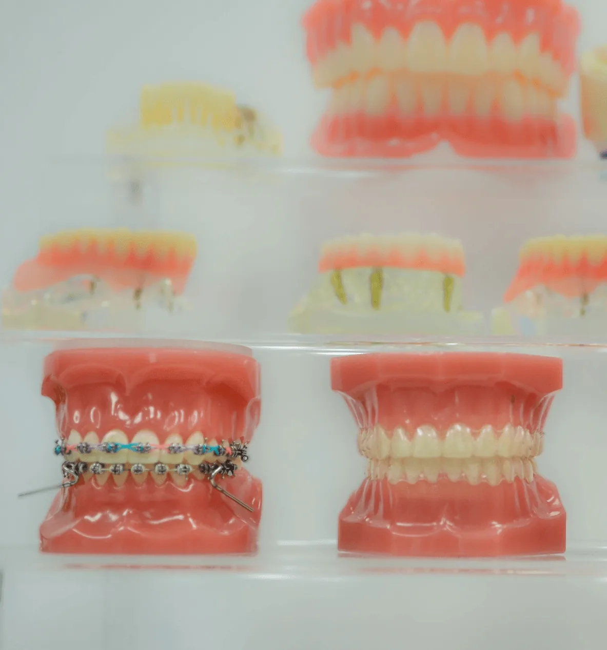 Benefits of Visiting Dental Offices That Focus on Comfort-First Treatment