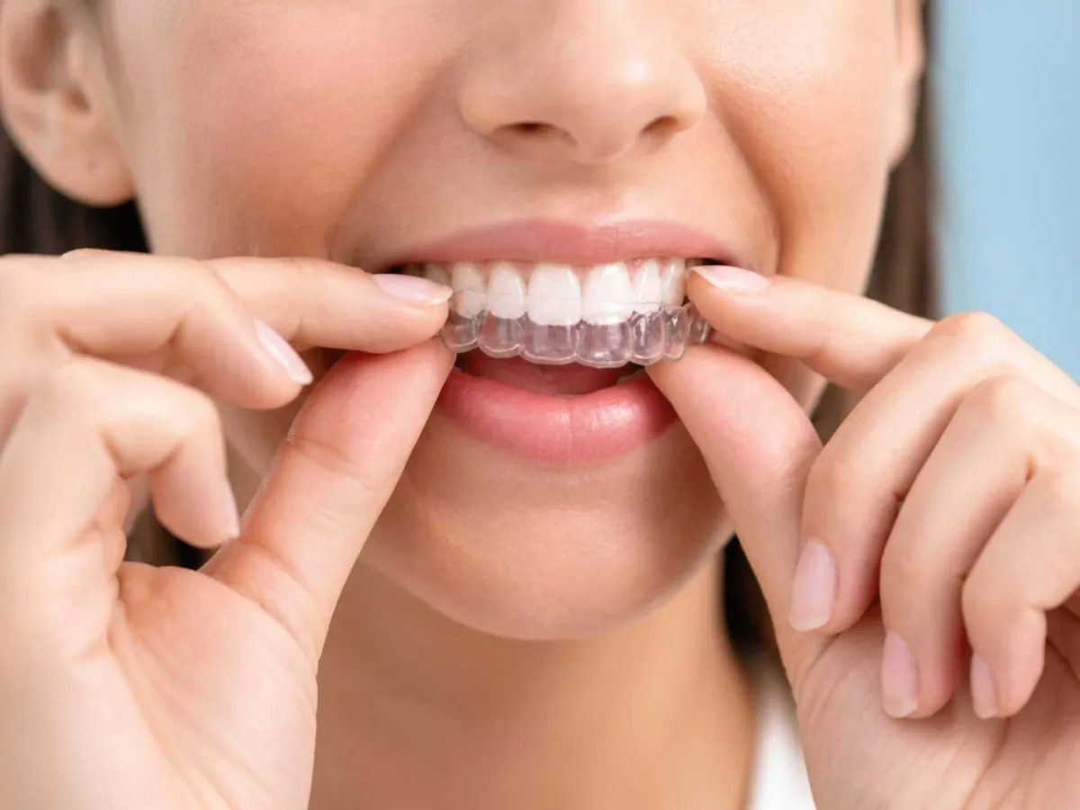 Invisalign® For Adults Vs Teens: Treatment and Lifestyle