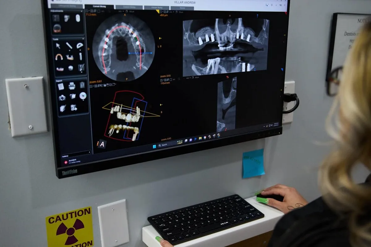 A monitor that shows someone's teeth