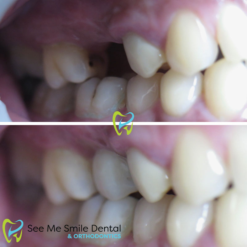 Implant West Covina