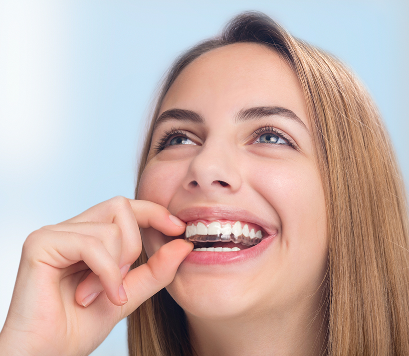Invisalign Benefits in West Covina CA