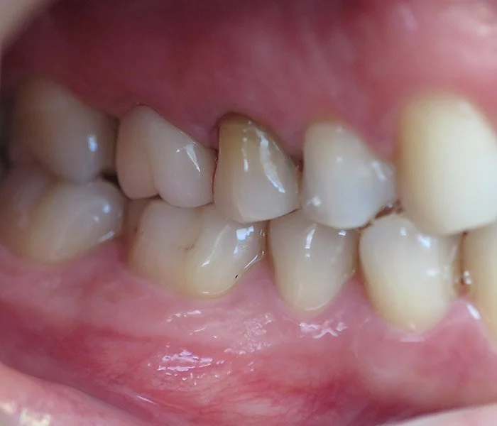 emergency dentist West Covina After